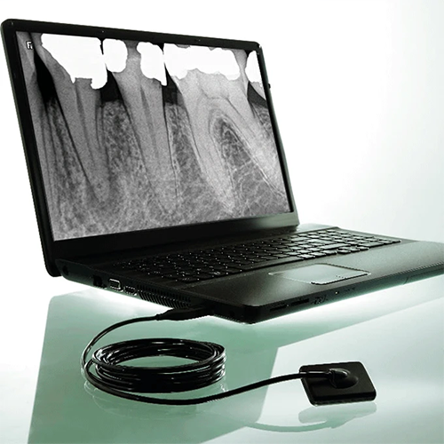 RVG (Radiographic Visualisation Graphic) System at Pearlline Multispeciality Dentocare the best dental clinic in Hosur
